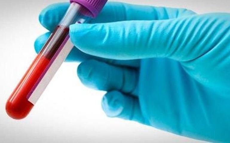 Postos de Saúde retomam coleta de sangue