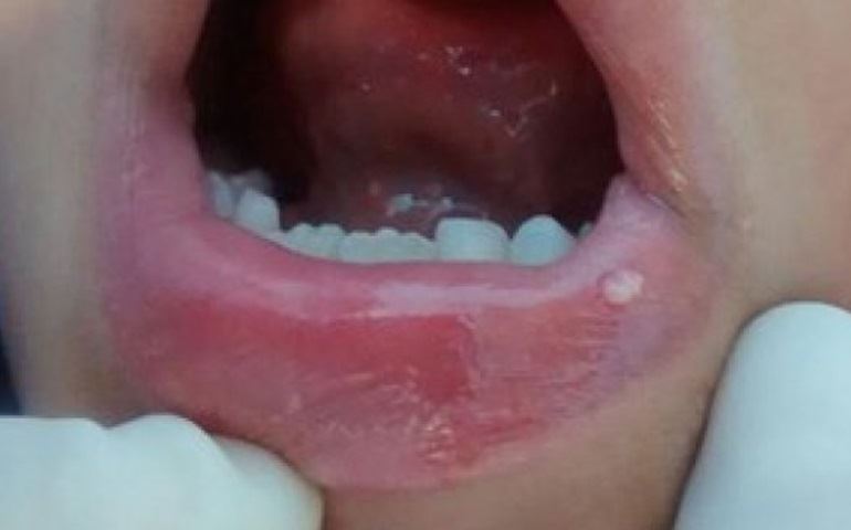 Mãe que soube de estupro de garoto ao ir a dentista vai procurar psicólogo