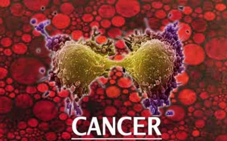 CÂNCER JÁ É A PRINCIPAL CAUSA DE MORTE EM 476 DAS 5.570 CIDADES BRASILEIRAS
