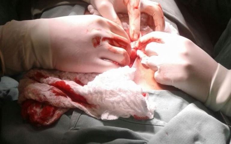 Preso passa por cirurgia para retirar dois aparelhos celulares do corpo