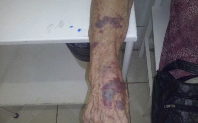 Homem é preso ao agredir a avó com socos e pontapés nos braços e rosto