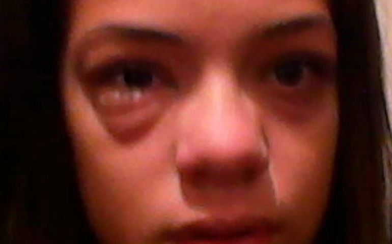 GAROTA DE TREZE ANOS RECEBE MEDICAÇÃO ERRADA EM TAQUARITUBA
