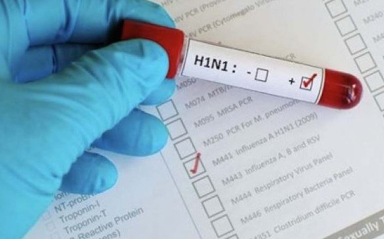 Brasil registra 1.571 casos de H1N1, com 290 mortes