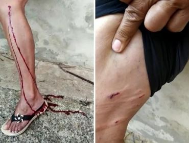 Moradora procura polícia após ser atacada por cachorros no interior de SP: 'Todo mundo tem medo'