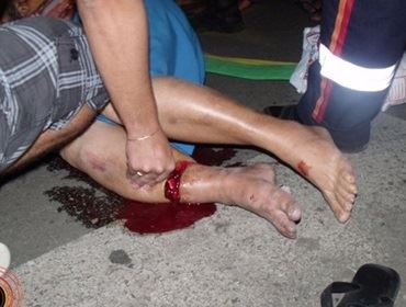 Atropelamento com vítima fatal no Jardim Tropical em Avaré.