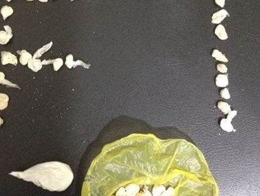 Uma mulher tentou engolir 46 pedras de crack após ser flagrada com a droga em Avaré (SP) na noite de