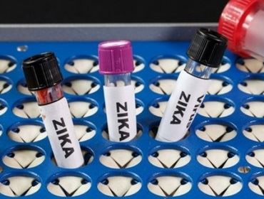 Exames de Zika serão obrigatórios para planos de saúde a partir desta semana