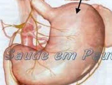 QUEM OPEROU DO ESTÔMAGO TERÁ 50% DE DESCONTO EM RESTAURNTES.